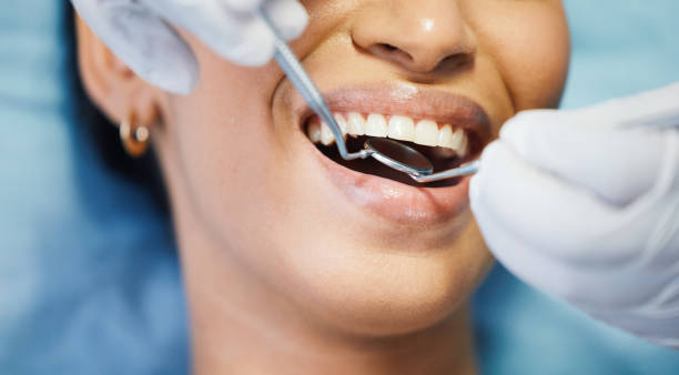 Best Emergency Dentist for Knocked-Out Tooth in Conway, FL